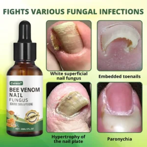 Cvreoz® Bee Venom Nail fungus care solution ：Natural Formula for Toenail & Fingernail Care