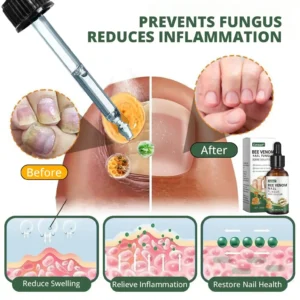 Cvreoz® Bee Venom Nail fungus care solution