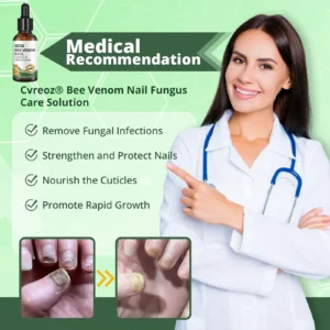 Cvreoz® Bee Venom Nail fungus care solution