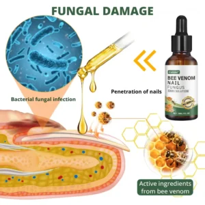 Cvreoz® Bee Venom Nail fungus care solution