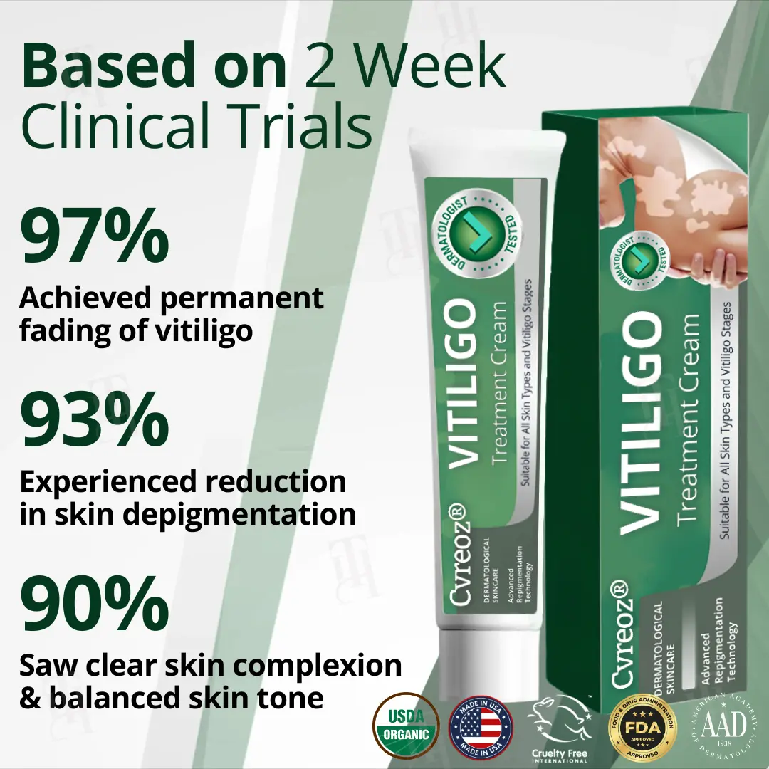 Cvreoz® Vitiligo Treatment Cream 5 Cvreoz® Vitiligo Treatment Cream - Image 5