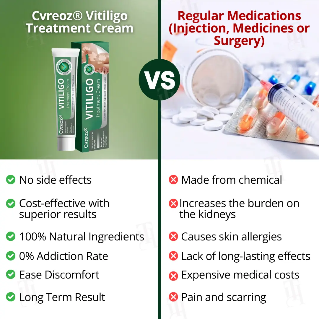 Cvreoz® Vitiligo Treatment Cream 6 Cvreoz® Vitiligo Treatment Cream - Image 6