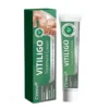 Cvreoz® Vitiligo Treatment Cream 28 Cvreoz® Vitiligo Treatment Cream