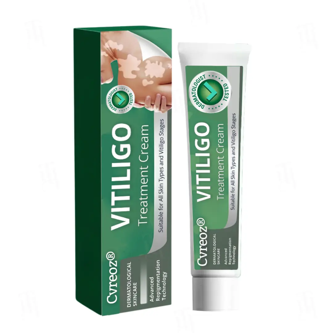 Cvreoz® Vitiligo Treatment Cream 1 Cvreoz® Vitiligo Treatment Cream