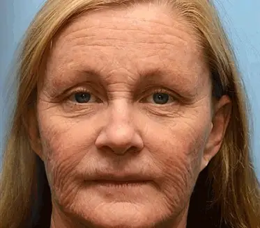 APKAPK™ Bee Venom Skin Treatment Cream 7 APKAPK™ Bee Venom Skin Treatment Cream