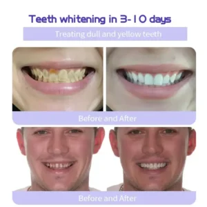 GarageLine™ Teeth Restoration Mineral Powder 29 GarageLine™ Teeth Restoration Mineral Powder