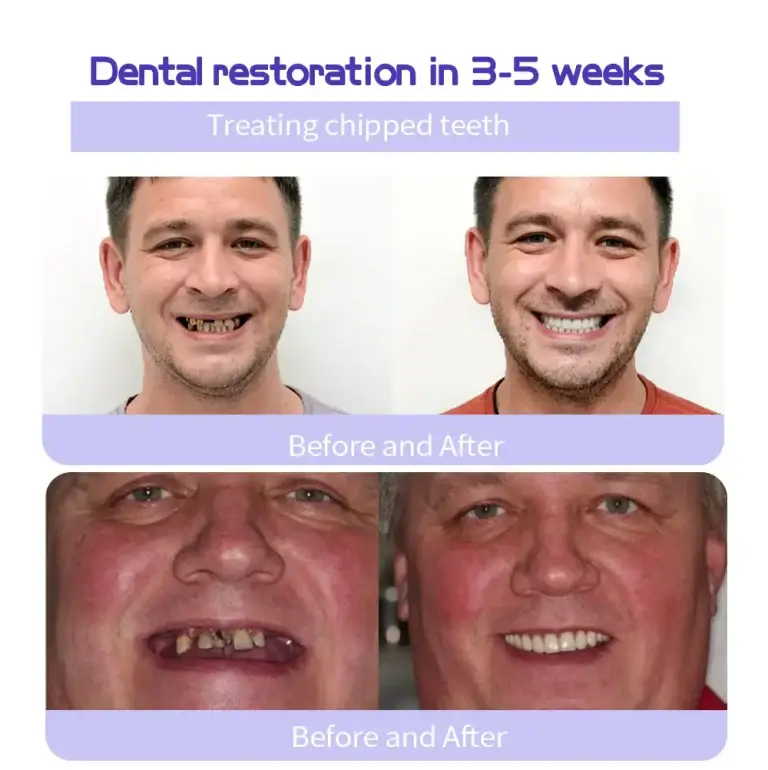 GarageLine™ Teeth Restoration Mineral Powder 8 GarageLine™ Teeth Restoration Mineral Powder