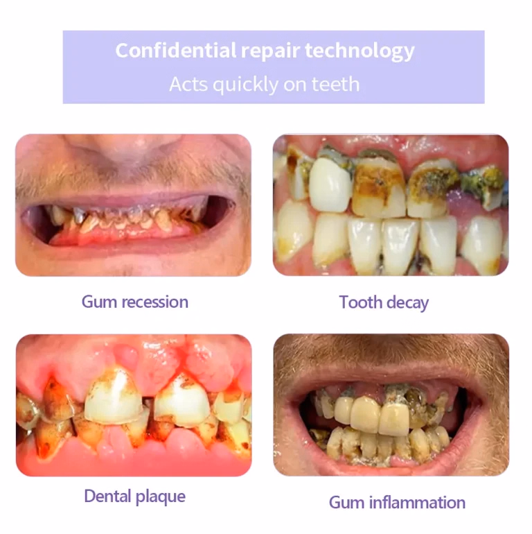GarageLine™ Teeth Restoration Mineral Powder 9 GarageLine™ Teeth Restoration Mineral Powder
