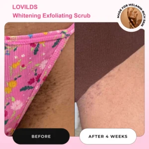 LOVILDS Whitening Exfoliating Scrub-Made in Israel 17 LOVILDS Whitening Exfoliating Scrub-Made in Israel