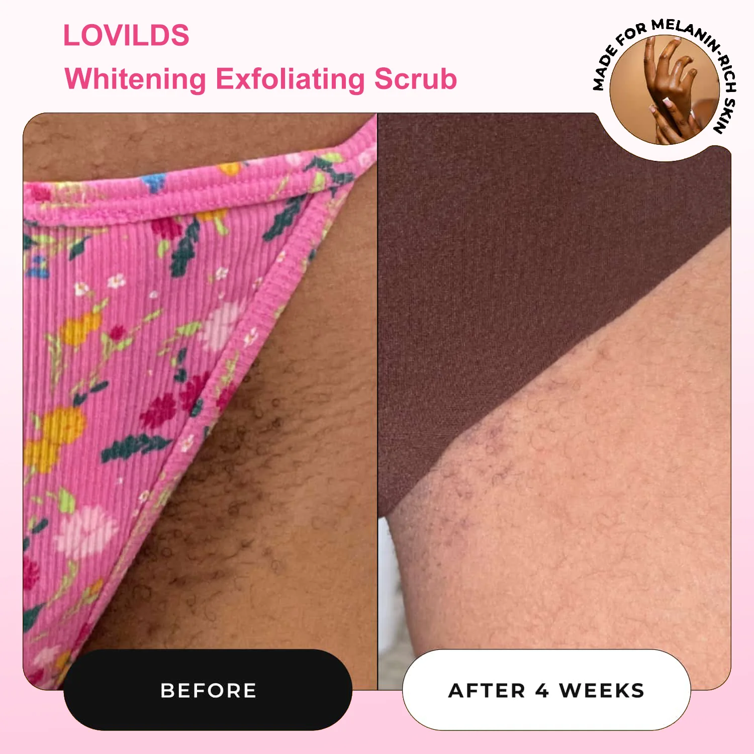 LOVILDS Whitening Exfoliating Scrub-Made in Israel 3 LOVILDS Whitening Exfoliating Scrub-Made in Israel - Image 3