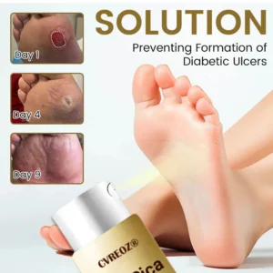 CVREOZ® DiaCure Bee Venom & Centella Diabetic Foot Ulcer Spray 12 CVREOZ® DiaCure Bee Venom & Centella Diabetic Foot Ulcer Spray