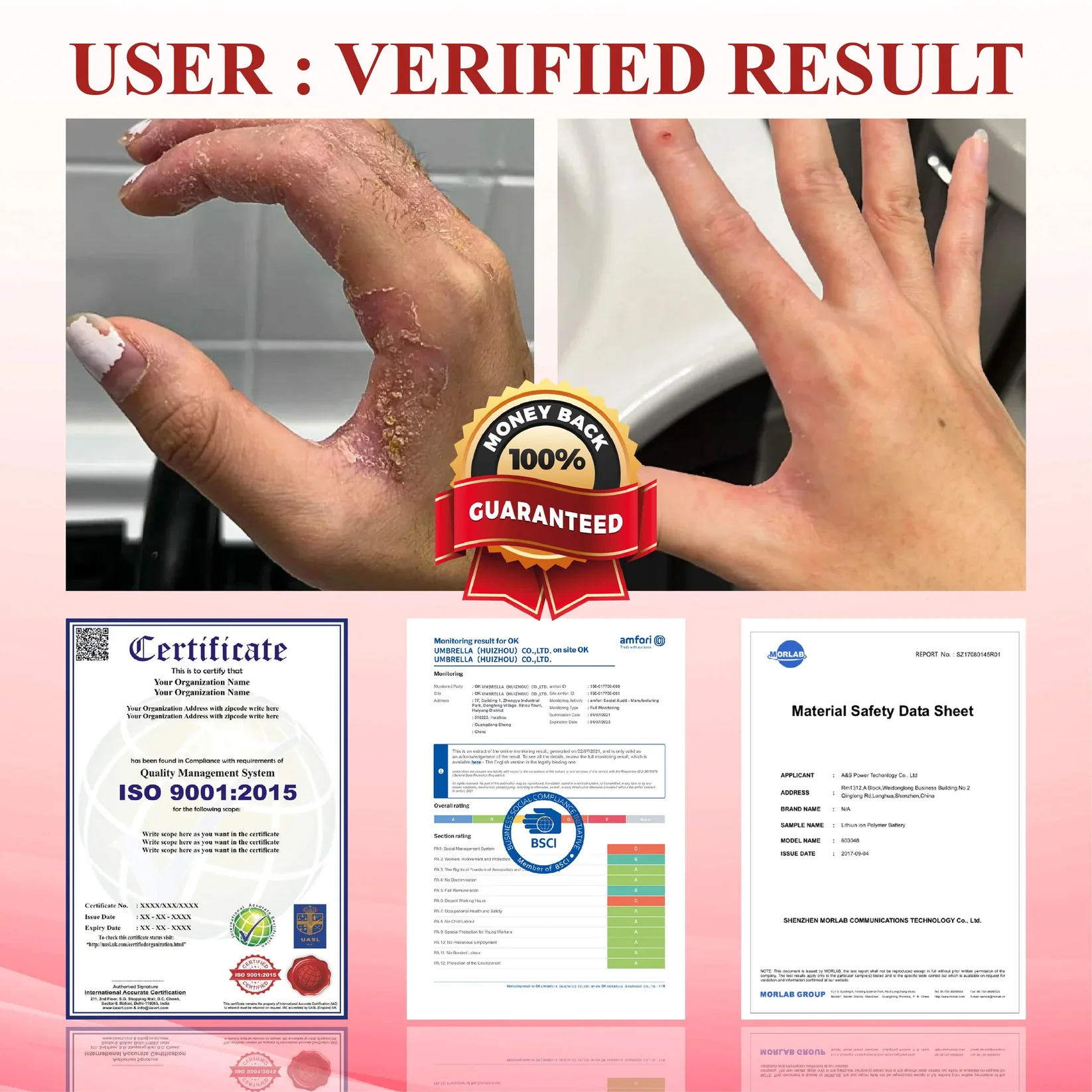 CVREOZ® GlucoseGuard Skin Rescue Cream 5 CVREOZ® GlucoseGuard Skin Rescue Cream - Image 5