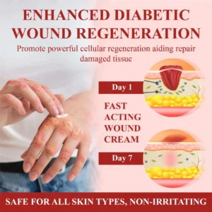 CVREOZ® GlucoseGuard Skin Rescue Cream 20 CVREOZ® GlucoseGuard Skin Rescue Cream