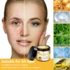 Oveallgo™ Bee Venom Skin Treatment Cream 15 Oveallgo™ Bee Venom Skin Treatment Cream