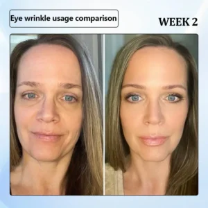 ϹΟRΟU® Nano Microneedle Wrinkle Patch 15 ϹΟRΟU® Nano Microneedle Wrinkle Patch