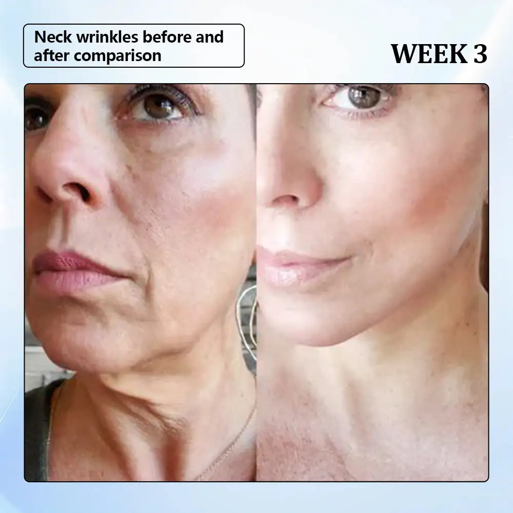 ϹΟRΟU® Nano Microneedle Wrinkle Patch 6 ϹΟRΟU® Nano Microneedle Wrinkle Patch - Image 6