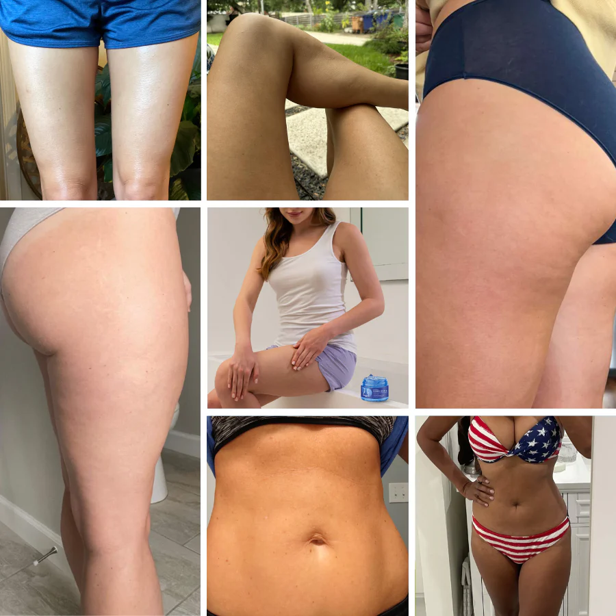 Fivfivgo® PDRN-GLP-1 Cellulite Targeting Reedle Shot Gel 9 Fivfivgo® PDRN-GLP-1 Cellulite Targeting Reedle Shot Gel - Image 9