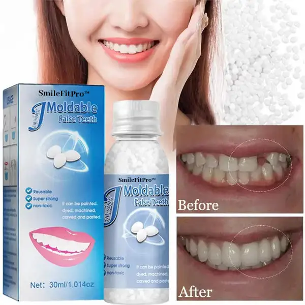 SmileFitPro™ Dental Filling Gel 4 SmileFitPro™ Dental Filling Gel - Image 4
