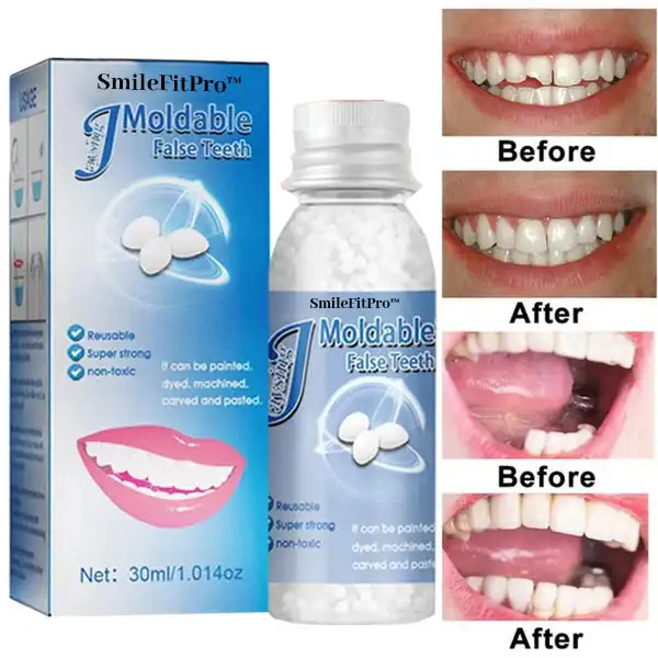 SmileFitPro™ Dental Filling Gel 6 SmileFitPro™ Dental Filling Gel - Image 6