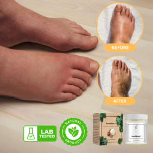 SwellEase™ Cream | Stop Aching Instantly