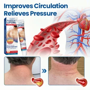 Cvreoz® BumpClear Lipoma Removal Cream 17 Cvreoz® BumpClear Lipoma Removal Cream