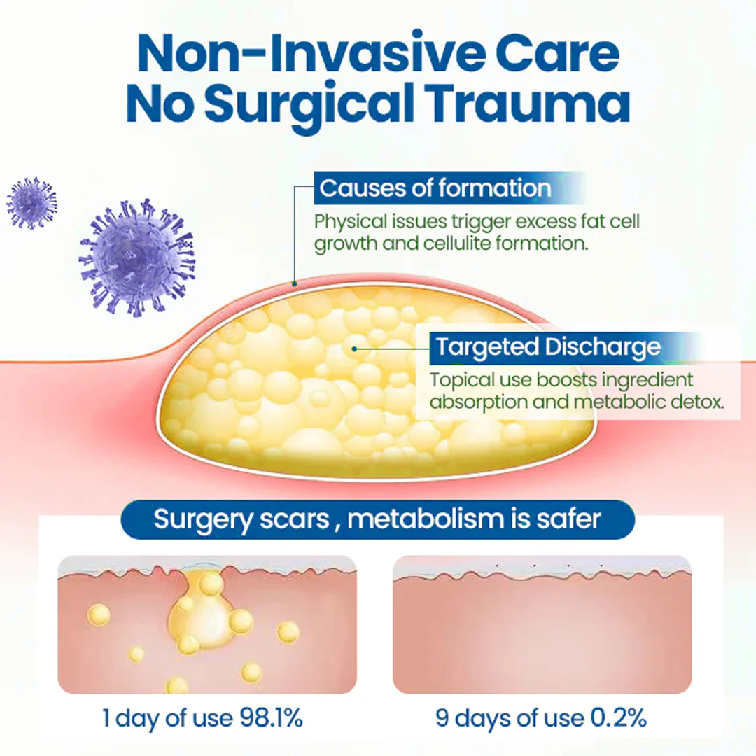 Cvreoz® BumpClear Lipoma Removal Cream 7 Cvreoz® BumpClear Lipoma Removal Cream - Image 7