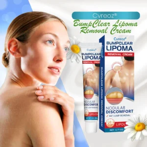 Cvreoz® BumpClear Lipoma Removal Cream 20 Cvreoz® BumpClear Lipoma Removal Cream