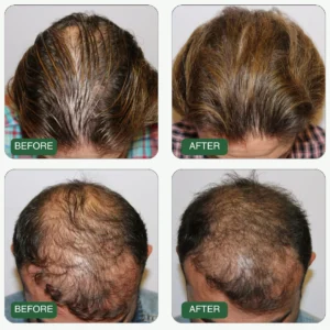 Growth Activation Serum™ - Sale 9 Growth Activation Serum™ - Sale