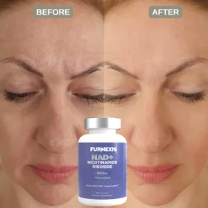 Furnexis NAD+ Nicotinamide Riboside Plus