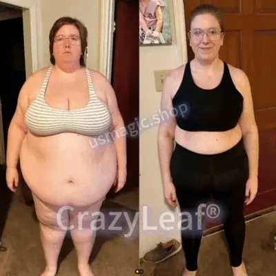 CrazyLeaf® Tirzepatide GIP/GLP-1 Dual-Action Slimming & Health Boost Drops 3 CrazyLeaf® Tirzepatide GIP/GLP-1 Dual-Action Slimming & Health Boost Drops