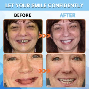 QIAWI™ Adsorptive denture