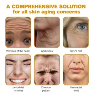 Kisshi™ Botox Bee Venom Wrinkle Removal Cream