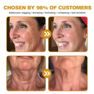 Furzero™ Botox Bee Venom Wrinkle Remover Cream