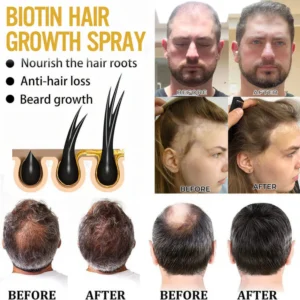 Cvreoz® Biotin Hair Essential Oil! 6 Cvreoz® Biotin Hair Essential Oil!