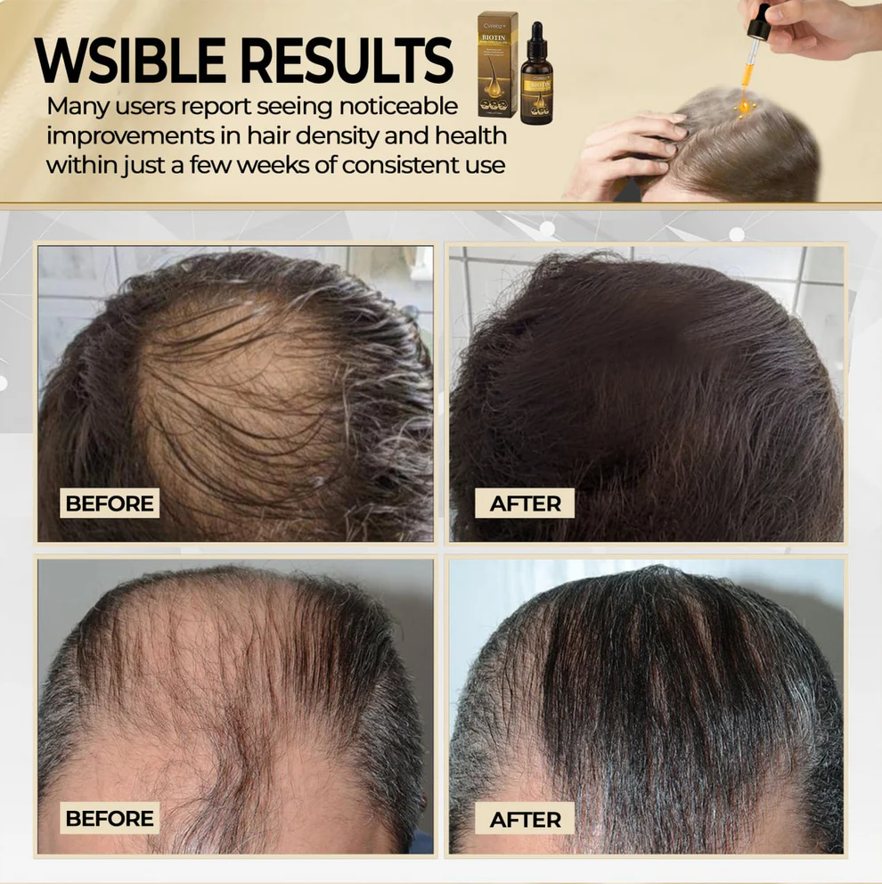 Cvreoz® Biotin Hair Essential Oil! 3 Cvreoz® Biotin Hair Essential Oil!