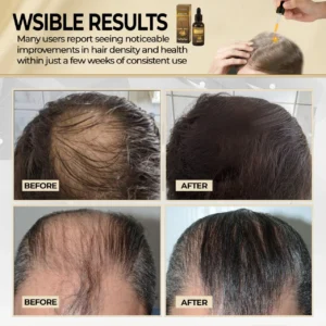 Cvreoz® Biotin Hair Essential Oil 17 Cvreoz® Biotin Hair Essential Oil