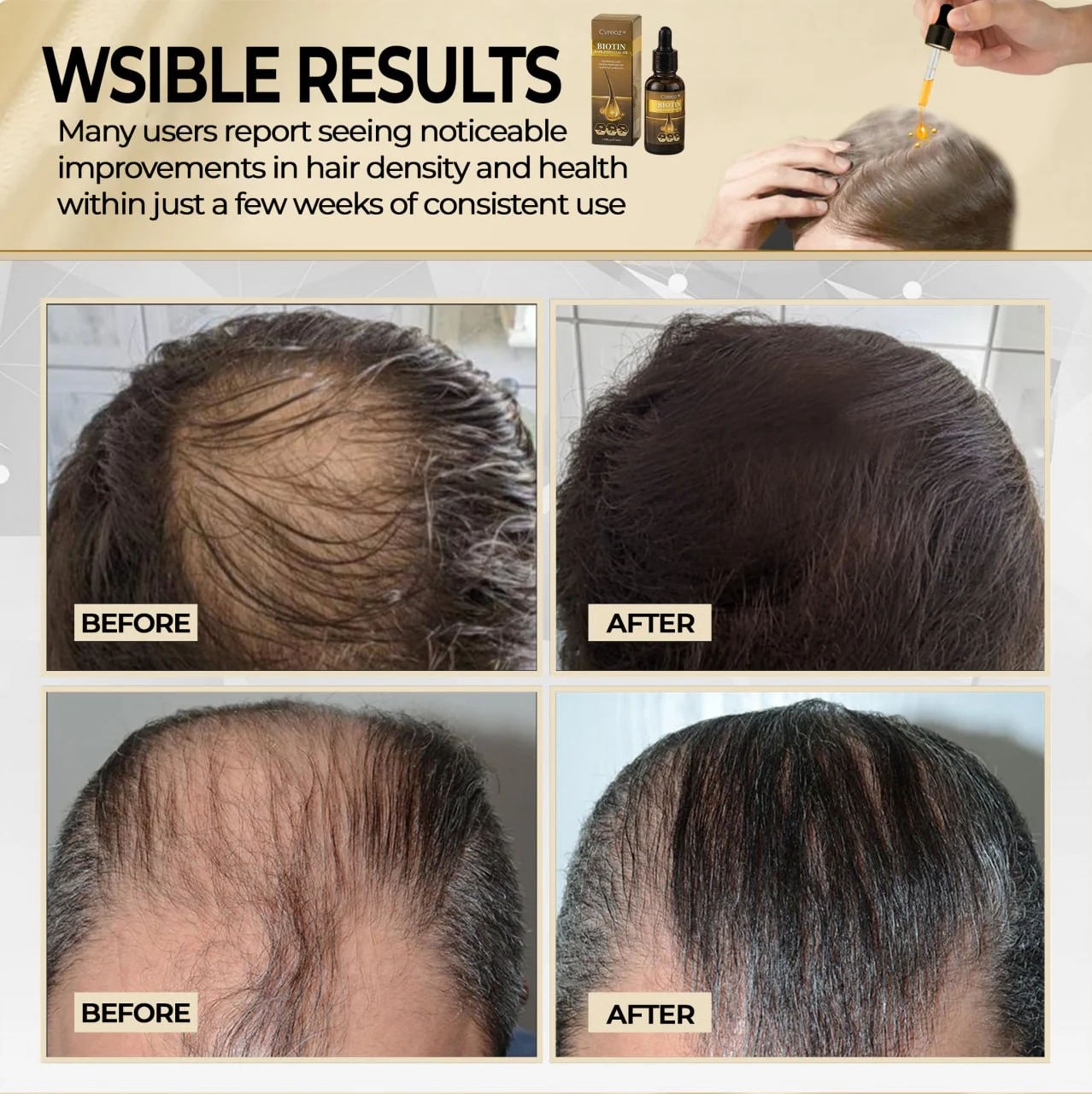 Cvreoz® Biotin Hair Essential Oil 8 Cvreoz® Biotin Hair Essential Oil - Image 8