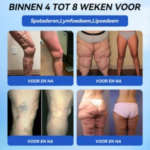 STDEI® GLP-1 Weight Loss Health Ampoule Oral Liquid 22 STDEI® GLP-1 Afvallen Gezondheid Ampul Orale Vloeistof