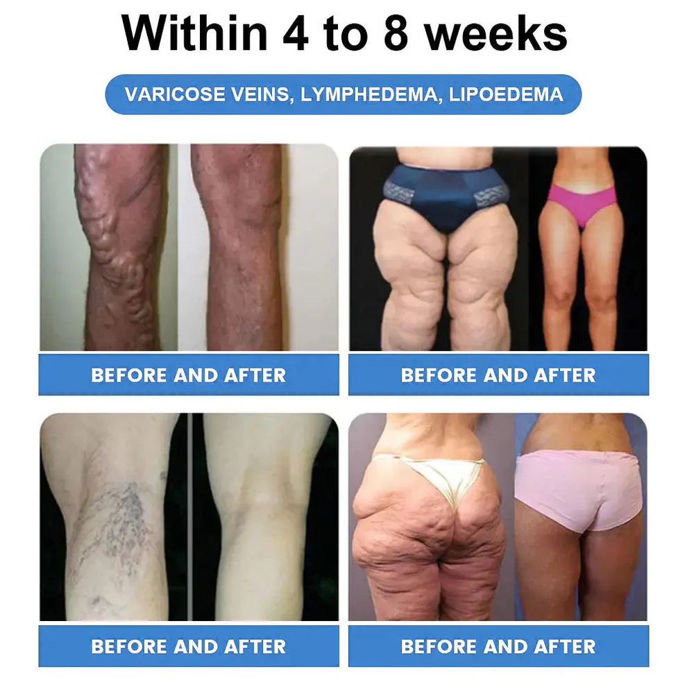 CROAIE® GLP-1 Slimming & Health Boost Drops 6 CROAIE® GLP-1 Slimming & Health Boost Drops