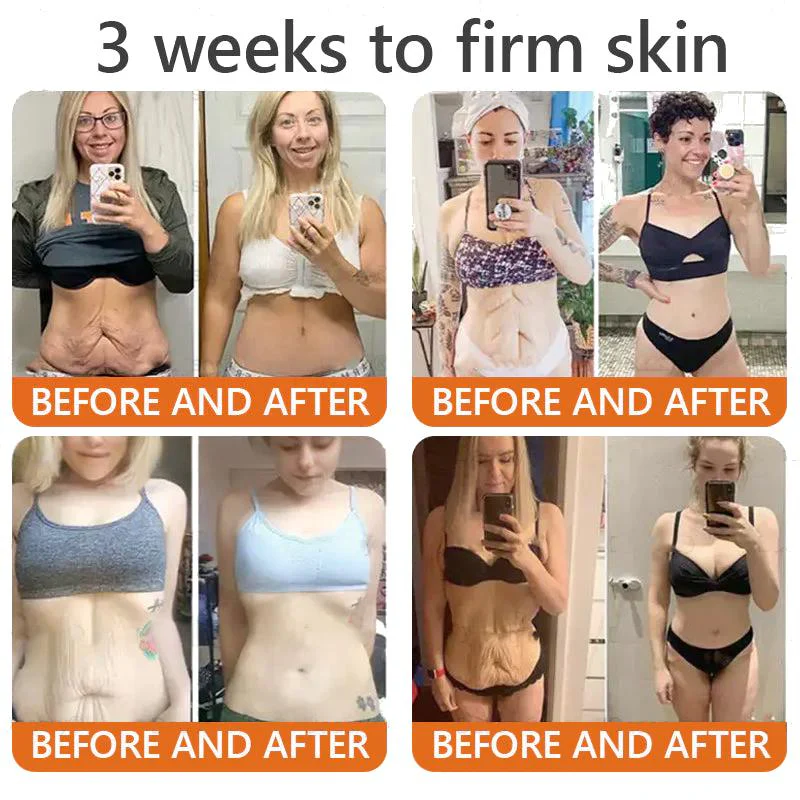 Cougex® "Dermal Gold" Botulin Bee Venom Skin Restoration Cream 3 Cougex® "Dermal Gold" Botulin Bee Venom Skin Restoration Cream