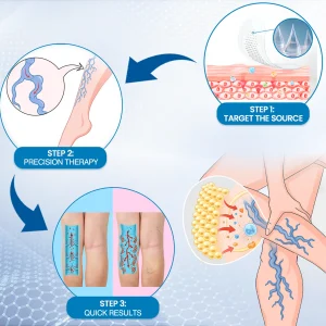 Ourlyard® Vein Ease Microneedle Care Patch - Cuttable 28 Ourlyard® Vein Ease Microneedle Care Patch - Cuttable