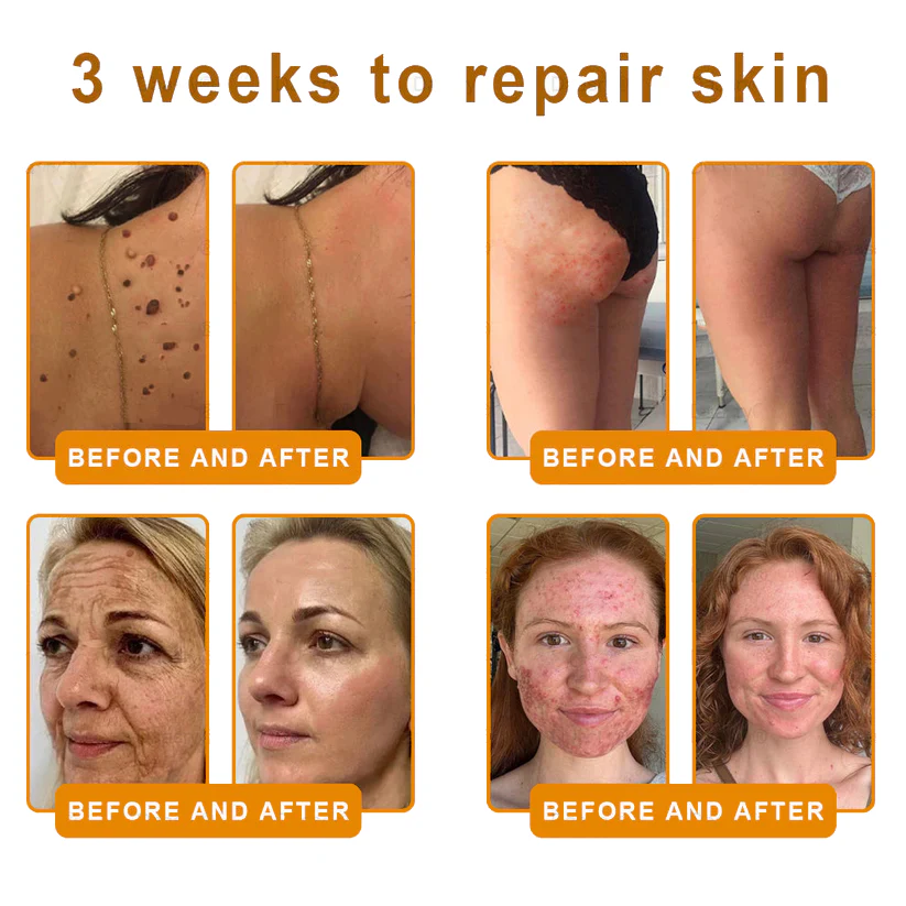 Cougex® "Dermal Gold" Botulin Bee Venom Skin Restoration Cream 4 Cougex® "Dermal Gold" Botulin Bee Venom Skin Restoration Cream