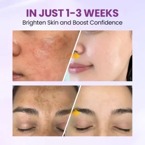 Biancat® RadiantClear Blemish & Brightening Serum 12 Biancat® RadiantClear Blemish & Brightening Serum