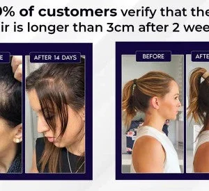 HZA™ Natural Hair Regrowth Spray 22 HZA™ Natural Hair Regrowth Spray