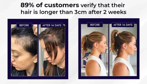 HZA™ Natural Hair Regrowth Spray 9 HZA™ Natural Hair Regrowth Spray