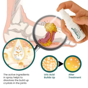 Cvreoz® GoutEase Relief Spray