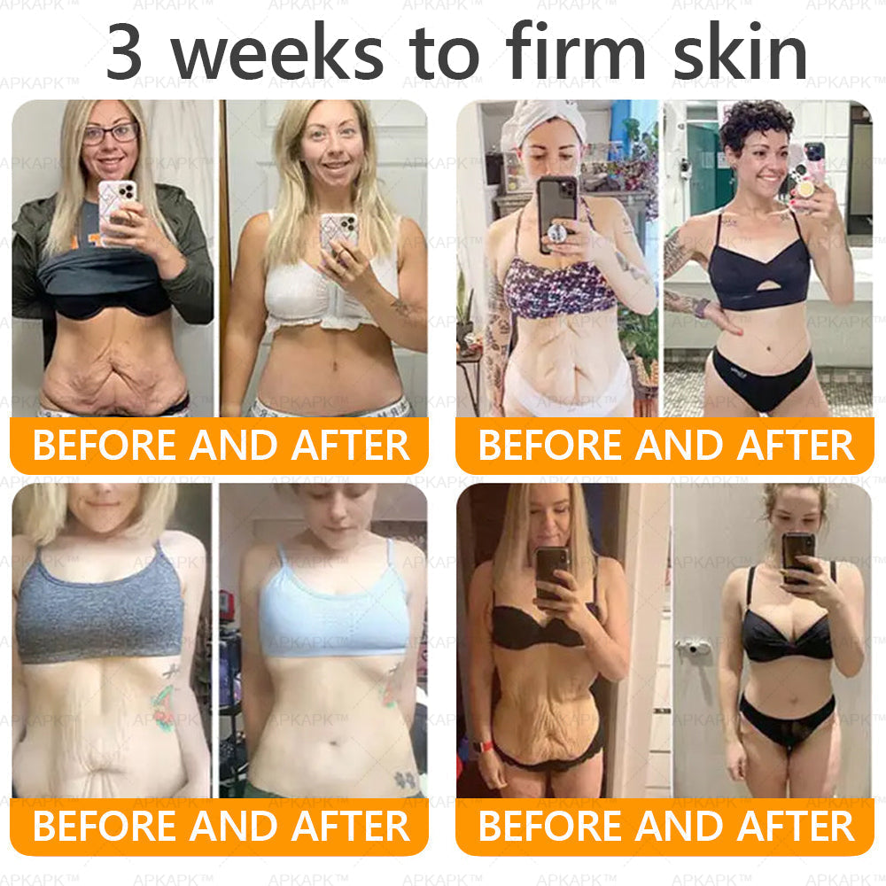 APKAPK® Bee venom Comprehensive Cream 2 APKAPK® Bee venom Comprehensive Cream