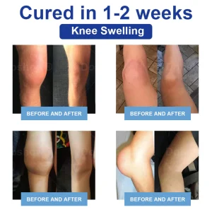 Cvreoz® JointRenew Joint Care Gel Roller Ball