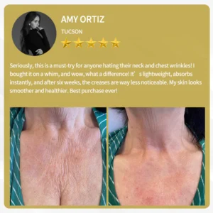 LOVILDS™ Bee Venom Cream — Trusted by Millions for Healthy, Glowing Skin 26 LOVILDS™ Bee Venom Cream — Trusted by Millions for Healthy, Glowing Skin