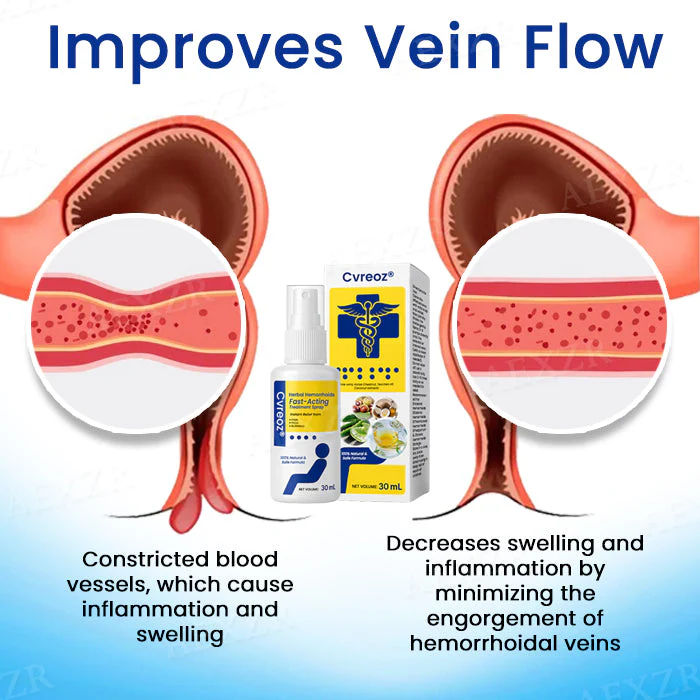 Cvreoz® Herbal Hemorrhoids Fast-Acting Treatment Spray 5 Cvreoz® Herbal Hemorrhoids Fast-Acting Treatment Spray